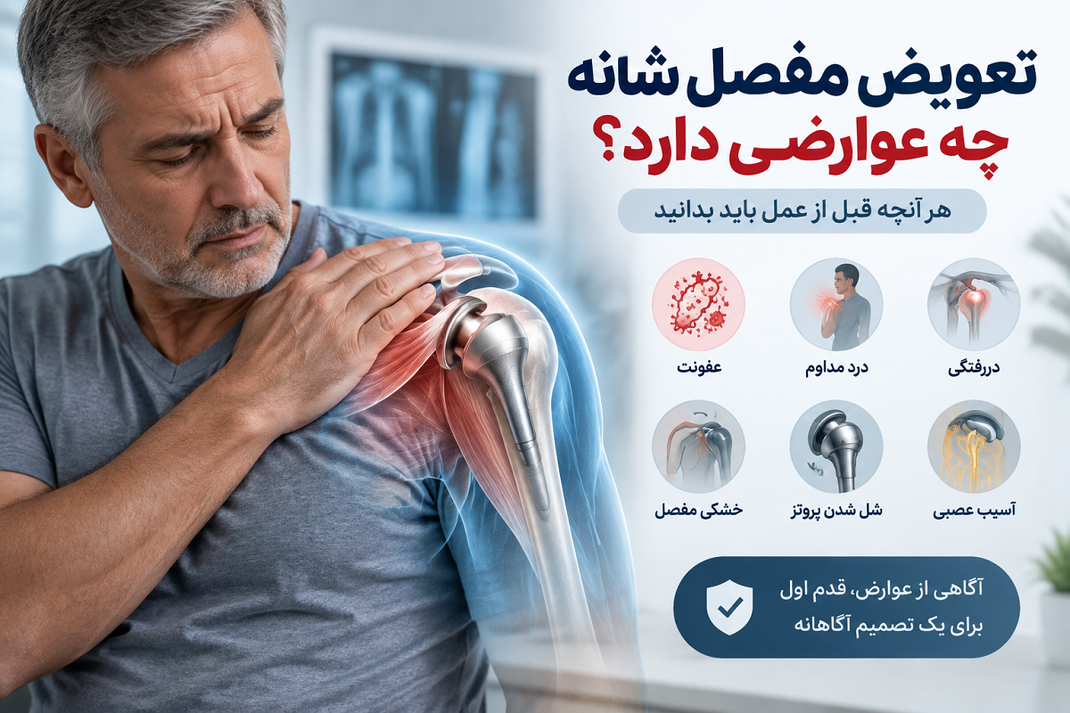تعویض مفصل شانه چه عوارضی دارد؟ هر آنچه قبل از عمل باید بدانید