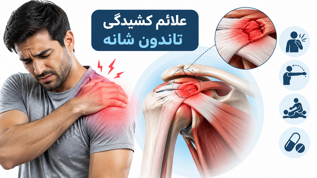 از کجا بفهمیم تاندون شانه کشیده شده است؟ علائم مهم و راه‌های درمان