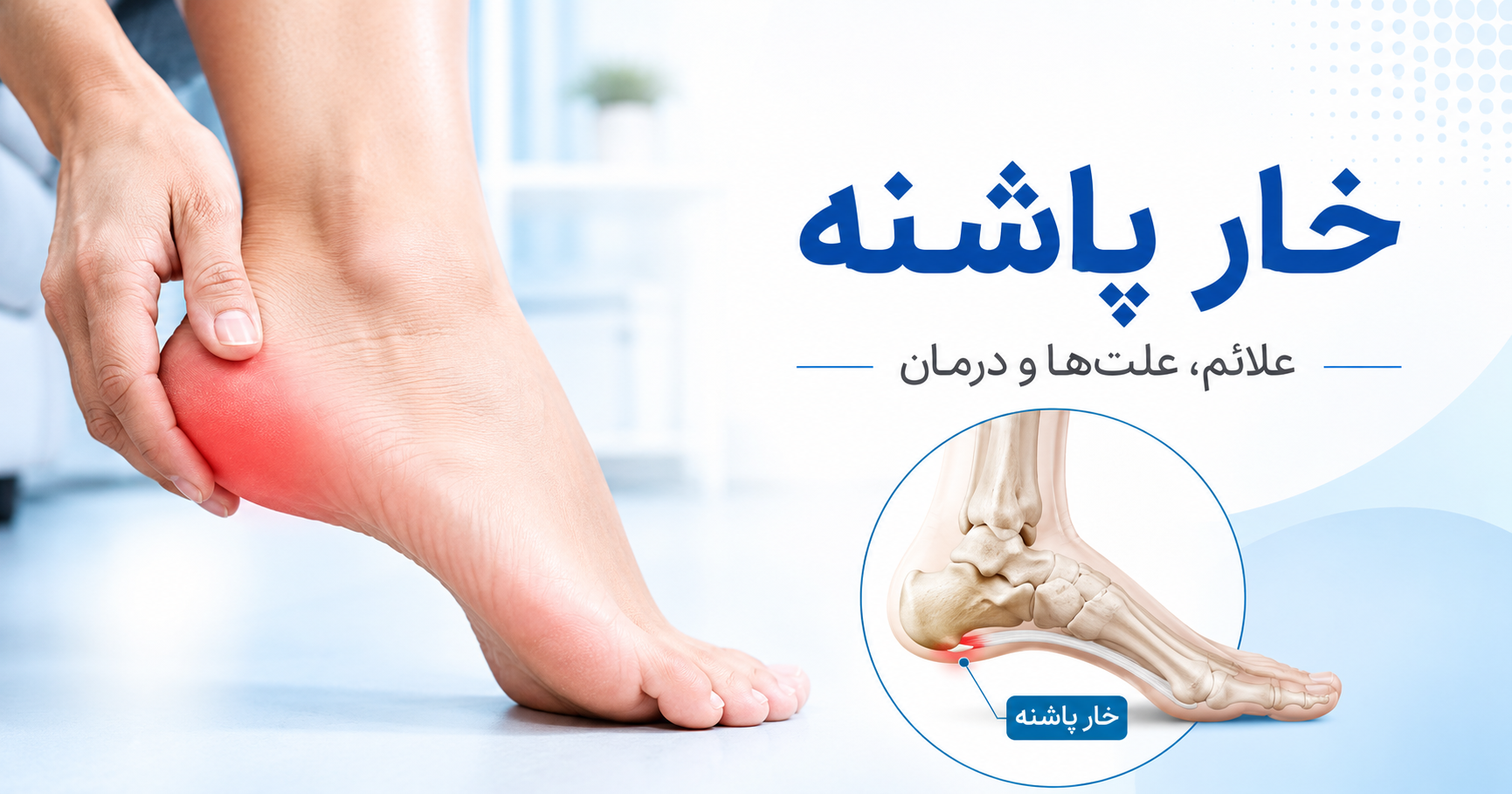 خار پاشنه چیست؟ علائم، علت‌ها و بهترین روش‌های درمان خار پاشنه
