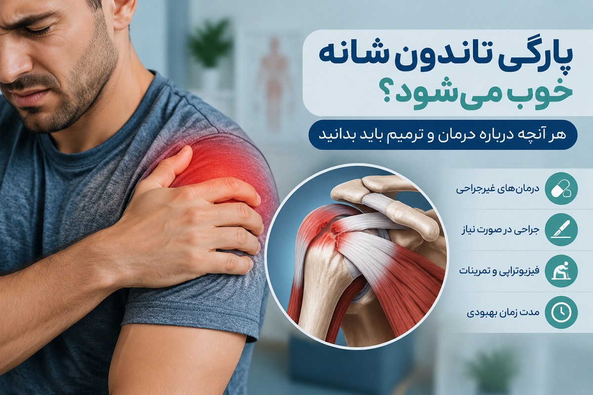 پارگی تاندون شانه خوب می‌شود؟ هر آنچه درباره درمان و ترمیم باید بدانید