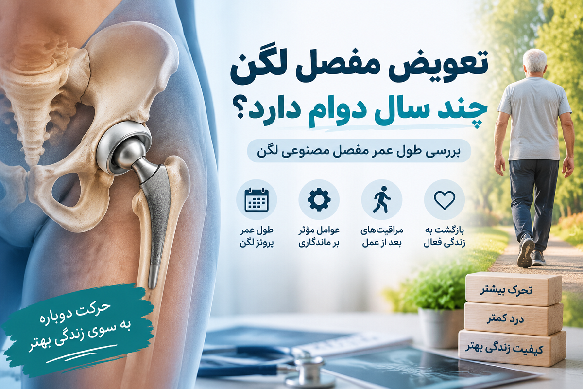 تعویض مفصل لگن چند سال دوام دارد؟ بررسی طول عمر مفصل مصنوعی لگن و عوامل مؤثر بر ماندگاری آن