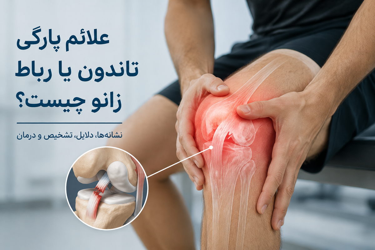 علائم پارگی تاندون یا رباط زانو چیست؟ نشانه‌هایی که نباید نادیده بگیرید